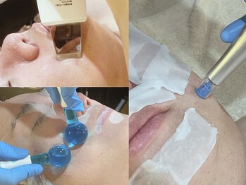 ムーア(muua)の写真/年齢ジワ×毛穴洗浄で若見え肌へ！リゼネレートによる高濃度幹細胞培養液浸透で内側から弾むハリ艶肌へ。