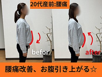 アオ整体院/妊娠8か月お客様B→A☆