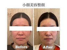 サロンベイビー 西宮本店(Salon Baby)の雰囲気(【小顔美容整顔(コルギ)3800円】当店人気No1/初回から効果を実感)