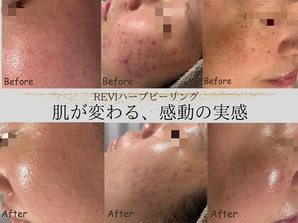 ルミライズ(lumirise)の写真