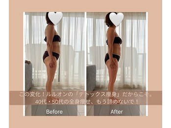 ヨサパーク リナータ(YOSA PARK Rinata)/40.50代必見!ハミ肉撃退。