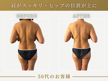 リムーン(REMOON.)/施術後の効果★50代のお客様