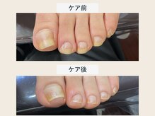ルポ 伊勢/爪ケア
