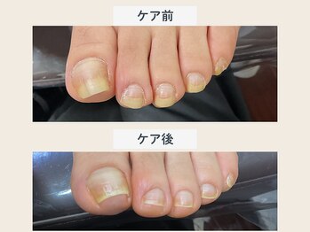 ルポ 伊勢/爪ケア