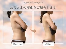 ヨサパーク ゴールデンツリー 浦安本店(YOSA PARK GordenTree)の雰囲気（20～40代女性からの口コミ多数♪高評価★4.8痩身/リンパ/小顔）