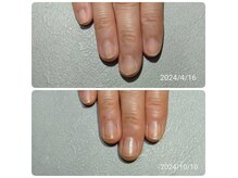 ネイルケア育成で友達から褒められる美爪になりました♪