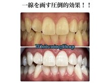 ホワイトニングショップ 岸和田店の雰囲気（他店とは一線を画す効果をご実感いただけます！）