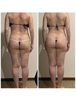 エステティックサロン アンジュ(Ange)/短期で痩せたい！結果重視！