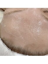 リシア(RECIA)/酵素ピーリング/2