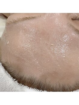 リシア(RECIA)/酵素ピーリング/2