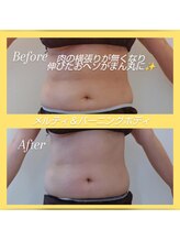 ヨリーズサロン(yoris.salon)/メラメラ燃やしてデトックス