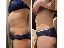 ビュップ 金沢店(美u p)の雰囲気（最新機器グロッティ脂肪熔解+ウルトランスフォーマーで結果出し）