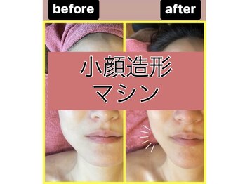 グラナーダ(granada)の写真/最新小顔マシン導入サロン！リピート率が自慢です！本格小顔専門店。理想の小顔を目指しましょう☆