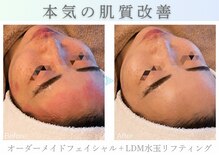 アマテラススキンラウンジ(Amatelas SKIN LOUNGE)