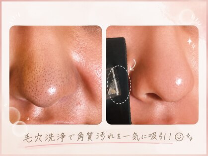 ステラ グランデ 福岡博多の写真