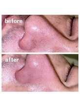 シエル(ciel)/before→after