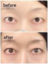 マシェリ(ma cherie)/パリジェンリフトラッシュリフト