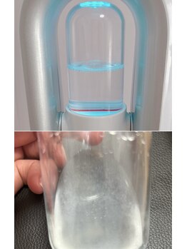 リジュベネ(rejuvena)/毛穴洗浄ビフォーアフター