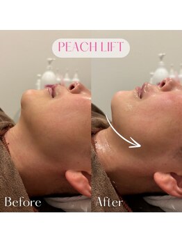 ポムハヌル 大阪梅田中崎町(pom.haneul)/韓国肌管理室