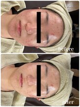 ジャスミン(Jasmin)/オーダーメイド高濃度原液導入