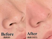 エサージュ 北千住店/アイブロウ×小鼻クレンジング