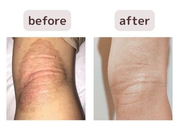 リジェネラティブセル メディカルサロン(Regenerative Cell Medical Salon)/ビフォーアフター