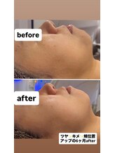 ジュネラ ボーテ(Jenela beaute)/美肌へ変化