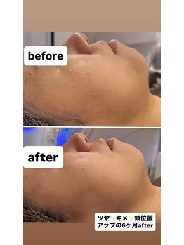 ジュネラ ボーテ(Jenela beaute)/美肌へ変化