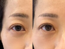 ライラック 二子玉川(Lilac)の雰囲気（大人女性の方　まつ毛でリフトアップ【マツエク/二子玉川】）