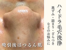 ダリア(Dahlia)/毛穴洗浄で触れたくなるお肌へ