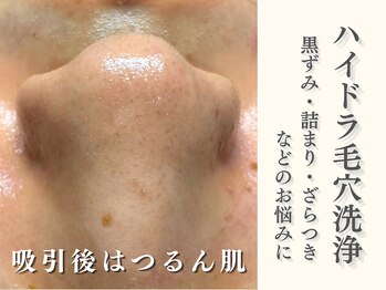 ダリア(Dahlia)/毛穴洗浄で触れたくなるお肌へ