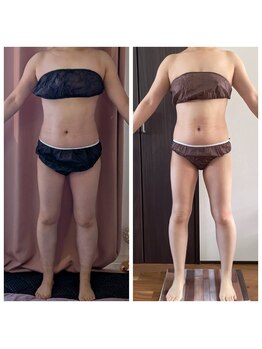 ヨサパーク ハッピーリーズス(YOSA PARK happy risus)/happyrisusだけの特別マッサージ