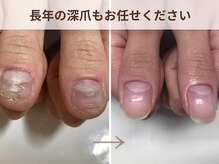 ブルームーンネイルズ(BLOOMOON.nails)/
