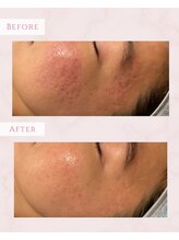 プレジール(Plaisir)/サーマトリックス★