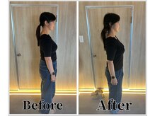 整体ラルース 中目黒(LALUZ)/50代　女性　猫背、肩こり改善