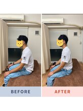 市川本八幡リーフ整骨院/ビフォーアフター/腰痛改善整体