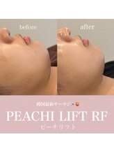 ポムハヌル 大阪梅田中崎町(pom.haneul)/韓国肌管理室