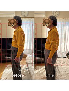 カイロプラクティック ネクサス/背中の激痛を撃退☆