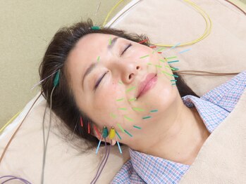 こころ鍼灸マッサージ院の写真/国家資格保有のスタッフによる本格施術で慢性的な肩こりや腰痛/急な痛みを根本から改善◎[首肩こり/美容鍼]