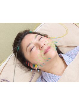 鍼灸施術を受けたい