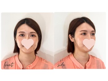 スタイルキューピット(style cupit)/メイクビフォアフター＊30代