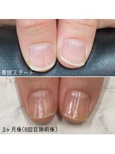 ネイルズ アヴァンティ(Nails Avanti)/自爪育成ネイルケア