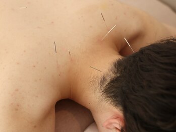 ハリノヒ 大阪院/