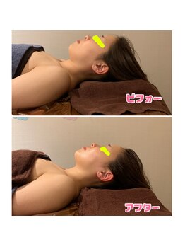 パルティール 銀座店 partir/夢の韓国美肌美小顔が叶います！