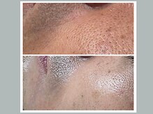 アンジェリーナの雰囲気（40代男性初めての毛穴洗浄¥7200→¥5800クスミのないクリアな肌）