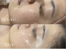 ウィハナ(wehana)