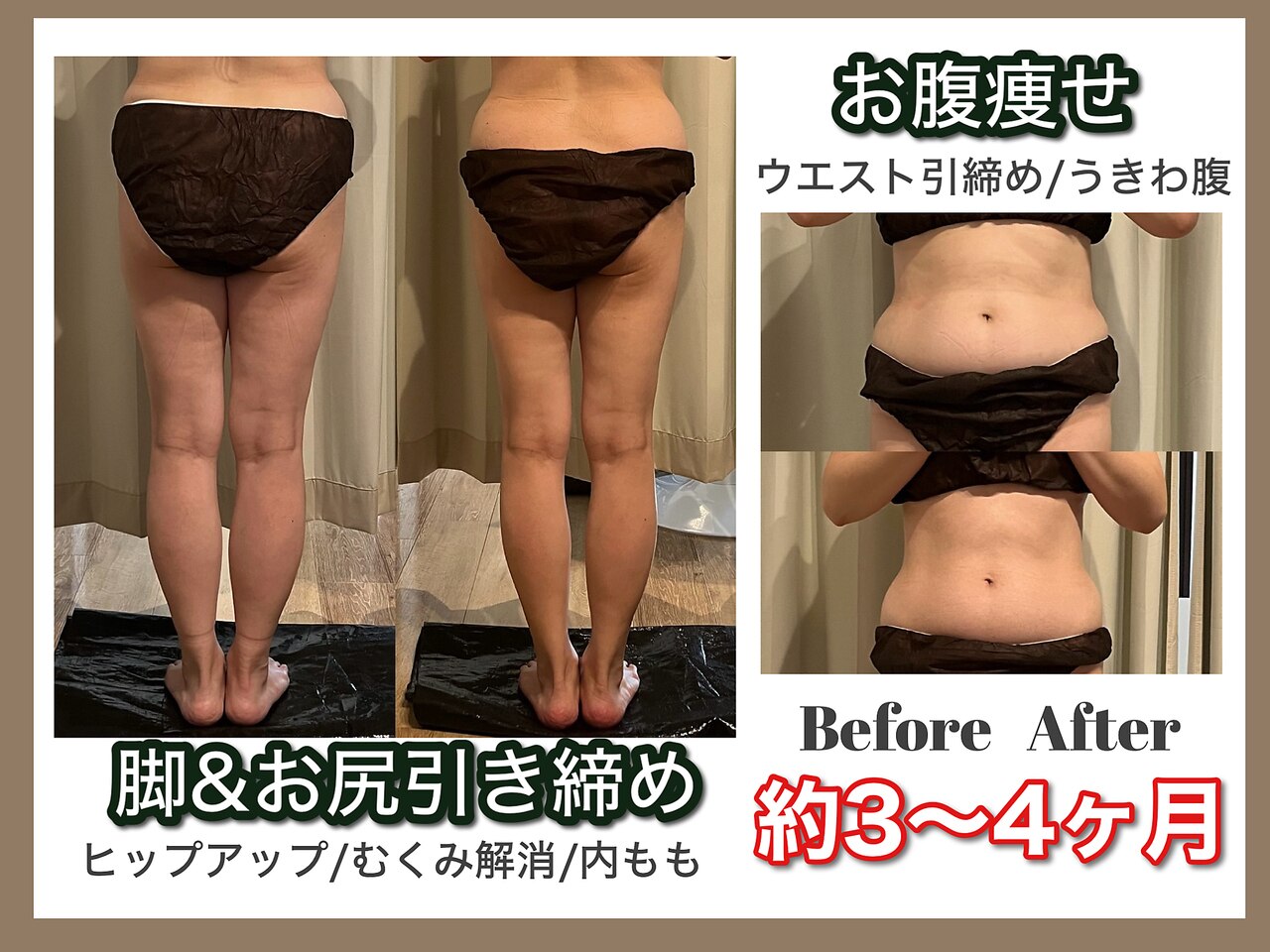 大阪市住吉区でキャビテーションが人気のエステサロン｜ホットペッパー