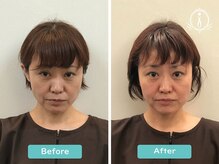 サロンアイ(salon i)の雰囲気（【他店では味わえないオリジナル】スペシャリストによる施術！）