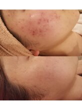 マーリィズエステティック(MARLEY'S AESTHETIC)