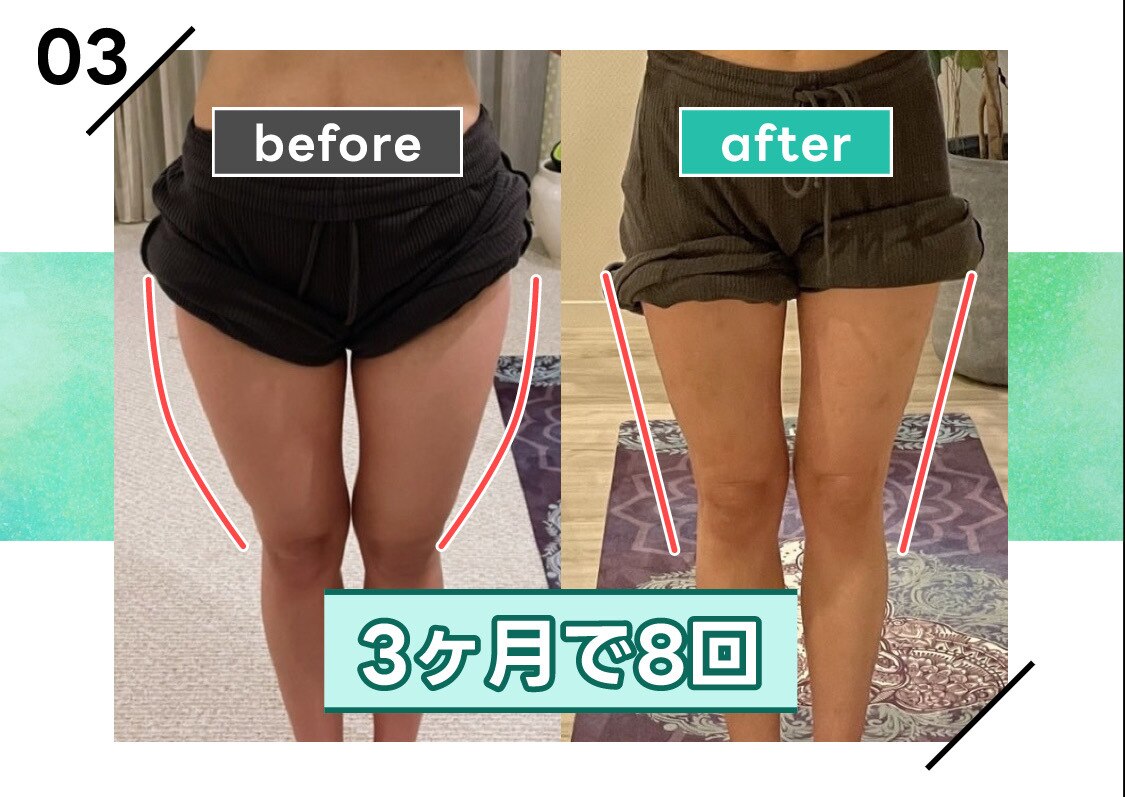 バスタイムボミー　痩身エステ　ダイエット 楽天市場】【1年保証】バスタイムボミー セルライト ダイエット